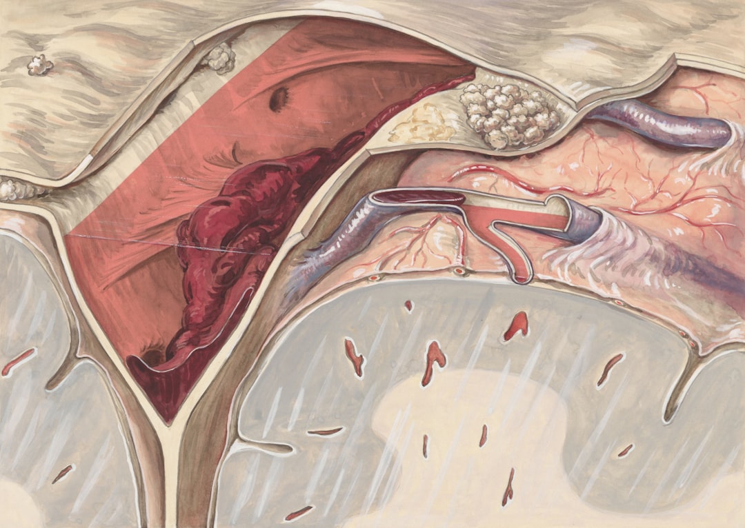 Ilustrație cu semnele unui accident vascular cerebral