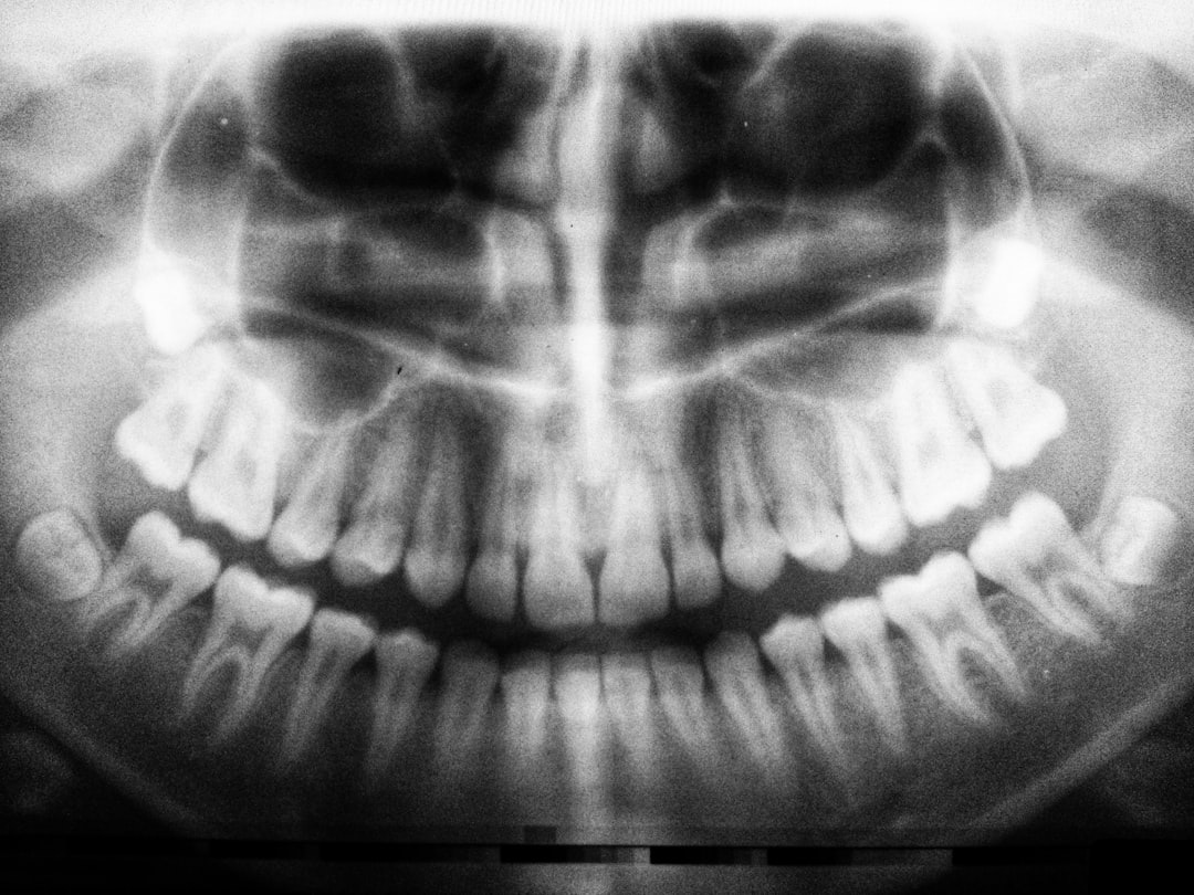 imagine cu un aparat dentar invizibil pe fundal alb