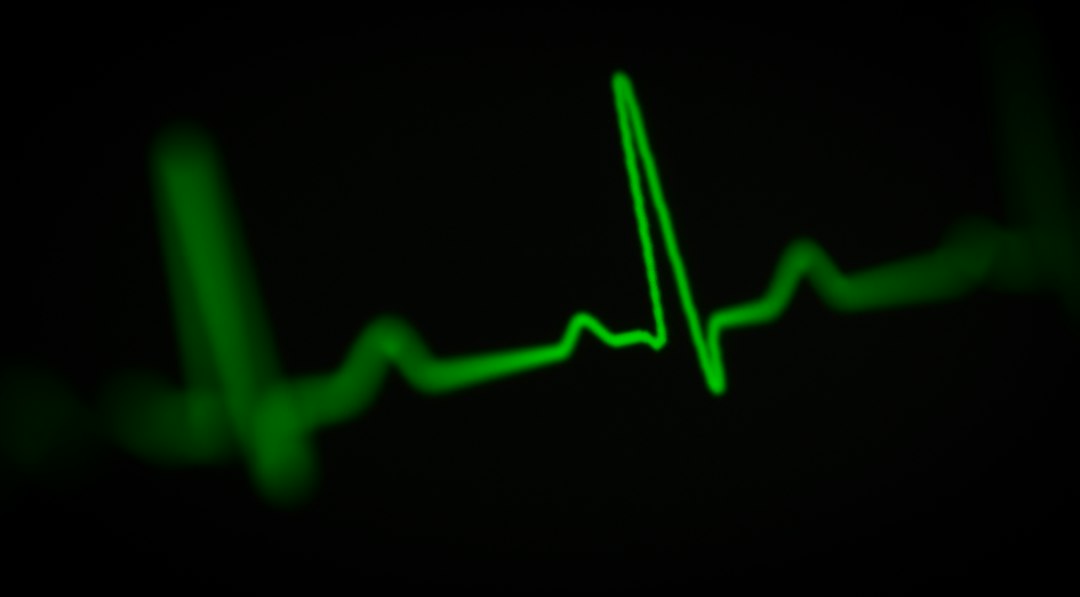 Imagine ilustrativă cu o electrocardiogramă și un aparat EKG