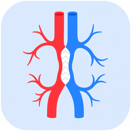 Chirurgie vasculara
